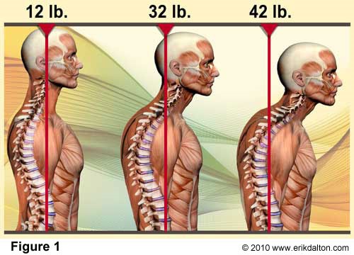 anterior-head-posture